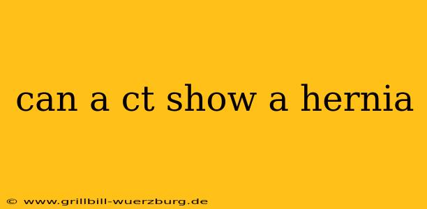 can a ct show a hernia